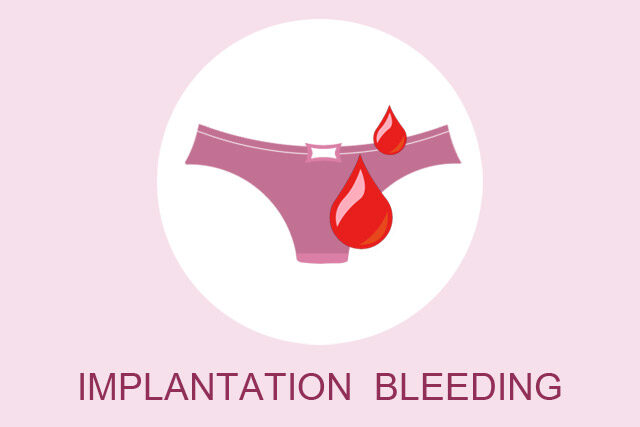 Read more about the article What Does Implantation Bleeding Look Like?