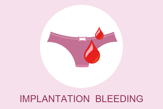 What Does Implantation Bleeding Look Like? - Motherhood Tips